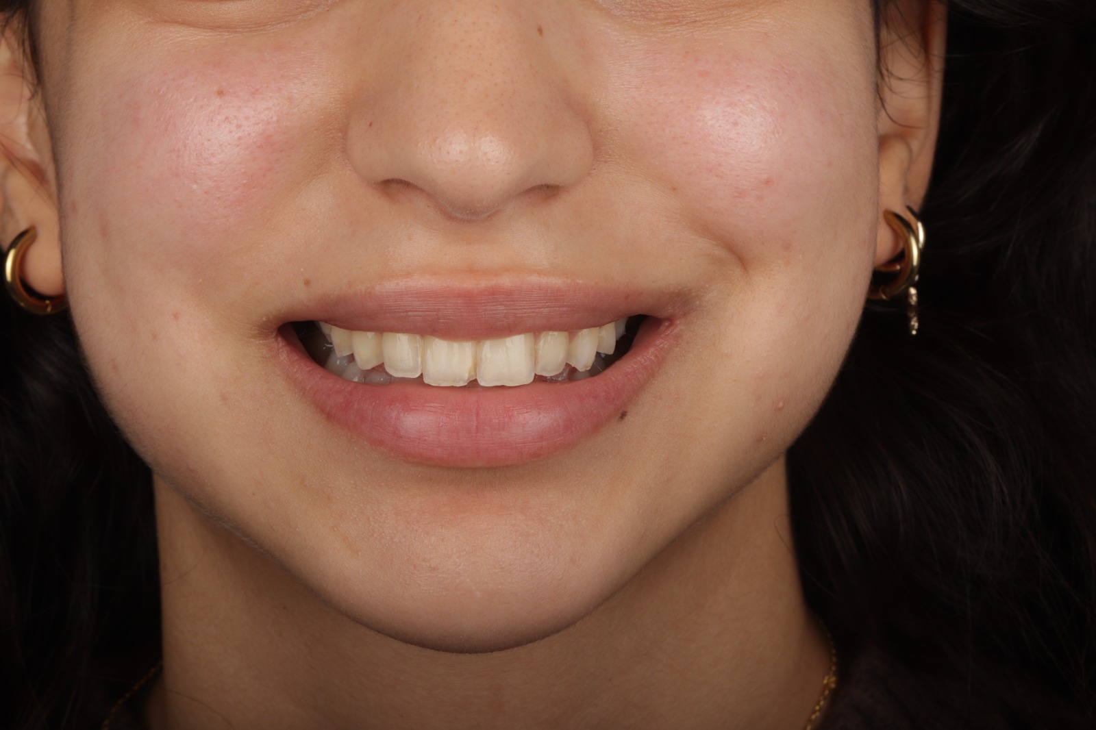 WhatsApp Image 2025-12-01 at 4.31.17 PM WhatsApp Image 2025-12-01 at 4.31.17 PM