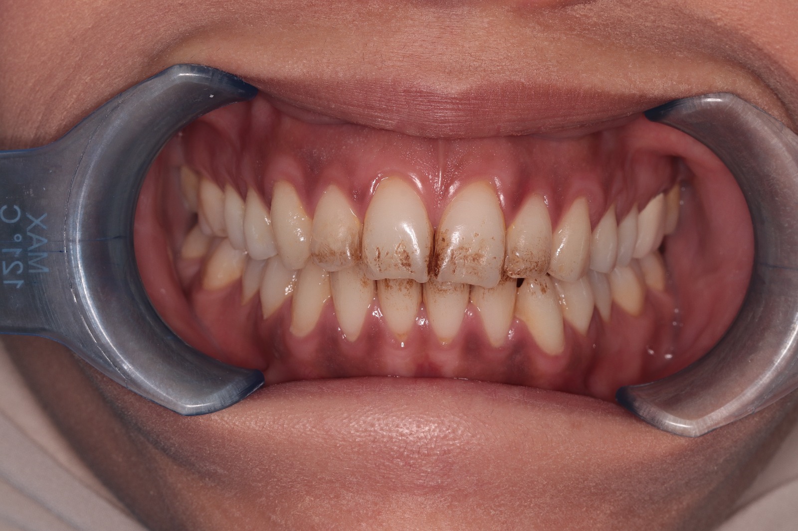 WhatsApp Image 2025-12-01 at 4.31.39 PM WhatsApp Image 2025-12-01 at 4.31.39 PM