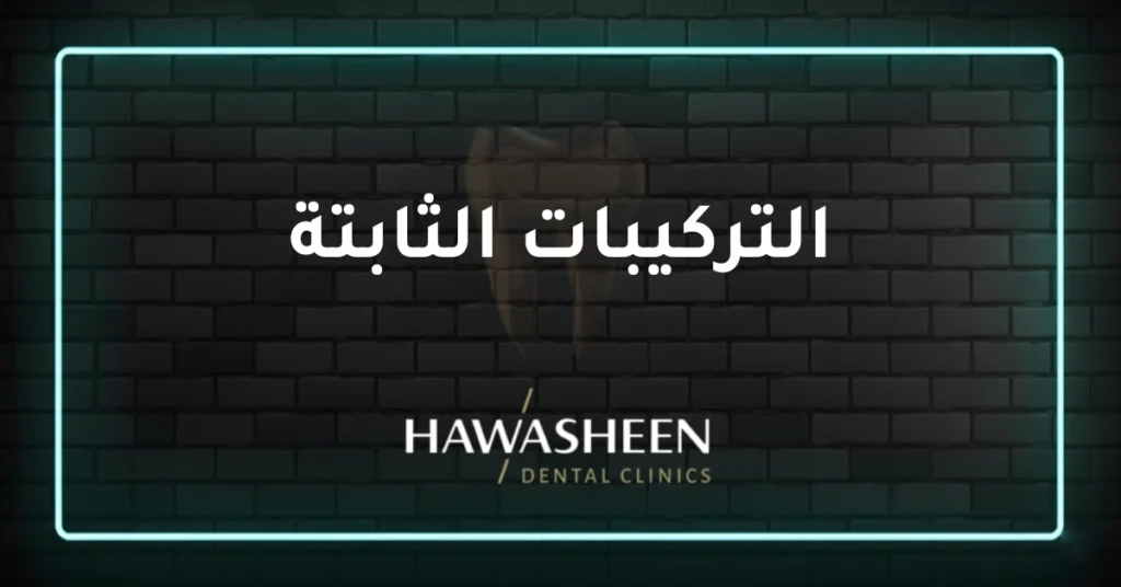التركيبات الثابتة - Dr Eyad Hawasheen - Hawasheen Dental Clinics