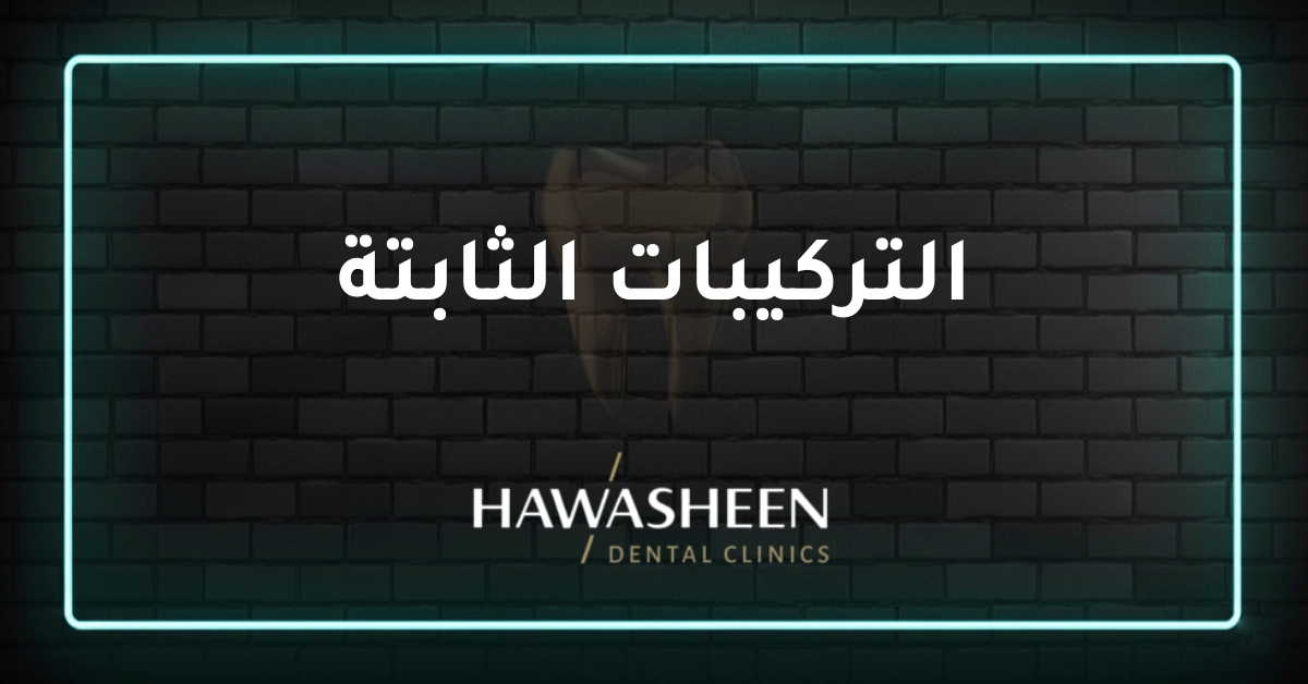 التركيبات الثابتة - Dr Eyad Hawasheen - Hawasheen Dental Clinics