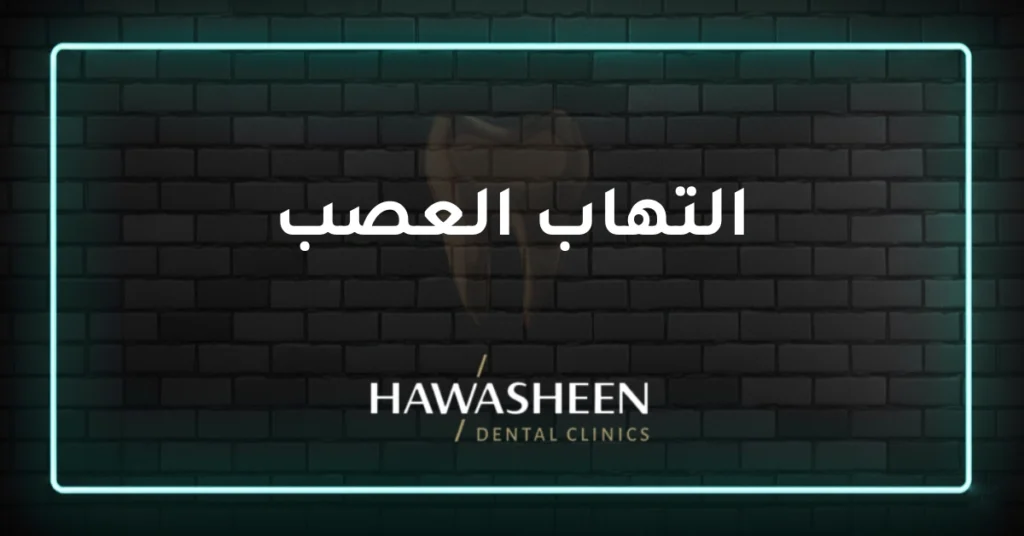 التهاب العصب - Dr Eyad Hawasheen - Hawasheen Dental Clinics
