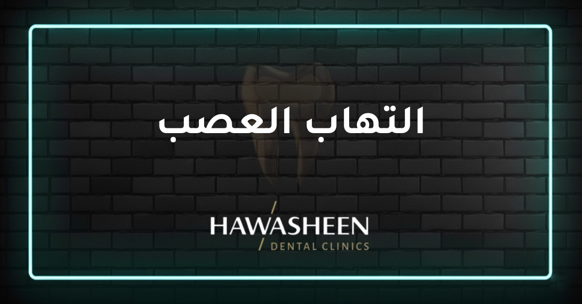 التهاب العصب - Dr Eyad Hawasheen - Hawasheen Dental Clinics