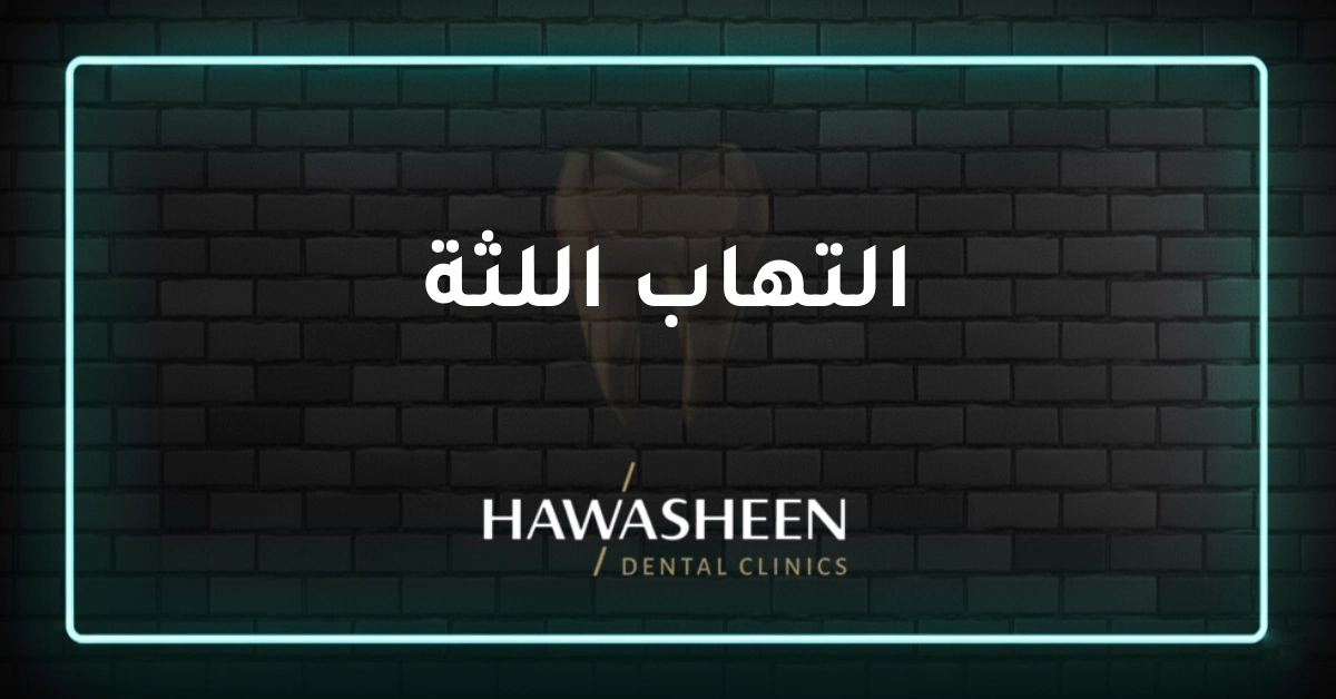 التهاب اللثة - Dr Eyad Hawasheen - Hawasheen Dental Clinics