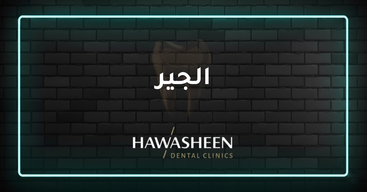الجير - Dr Eyad Hawasheen - Hawasheen Dental Clinics