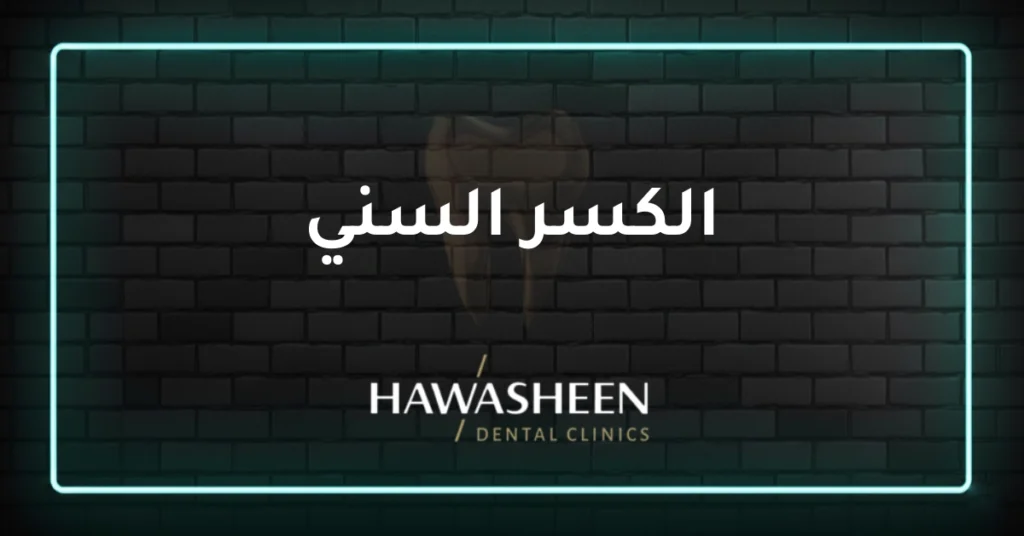 الكسر السني - Dr Eyad Hawasheen - Hawasheen Dental Clinics