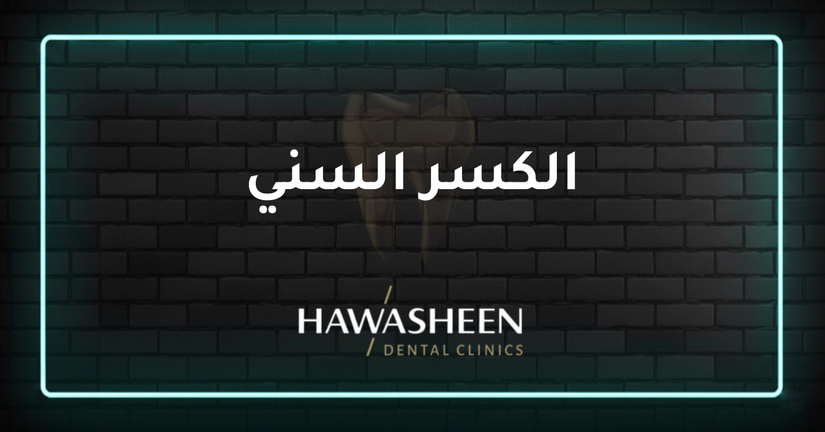 الكسر السني - Dr Eyad Hawasheen - Hawasheen Dental Clinics