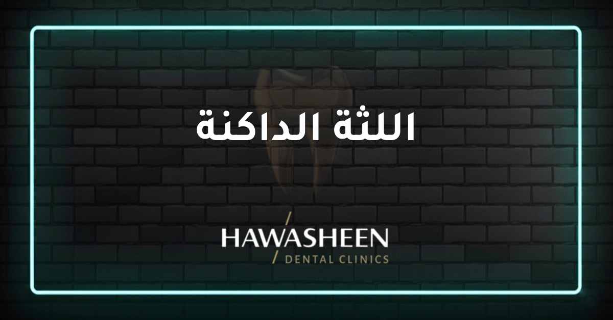اللثة الداكنة - Dr Eyad Hawasheen - Hawasheen Dental Clinics
