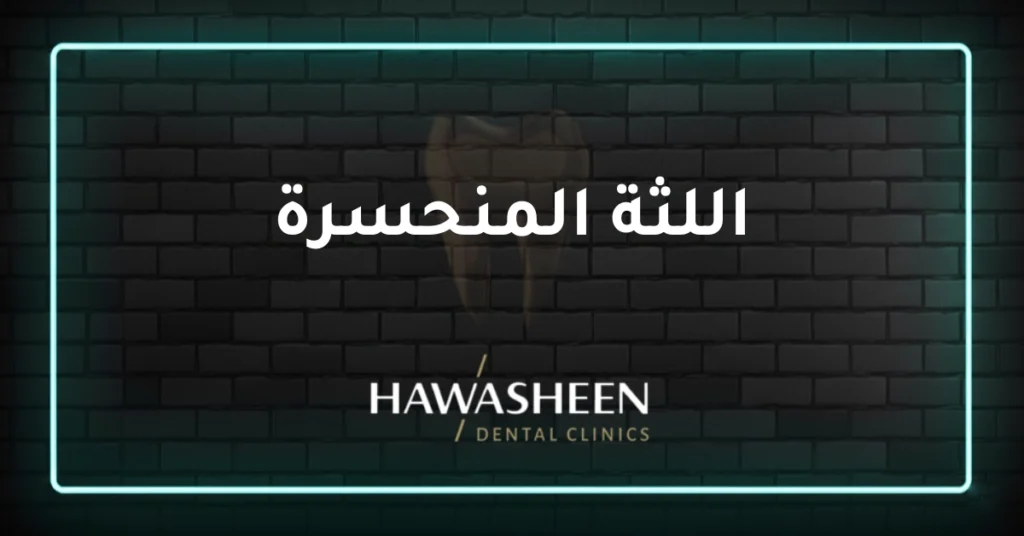 اللثة المنحسرة - Dr Eyad Hawasheen - Hawasheen Dental Clinics