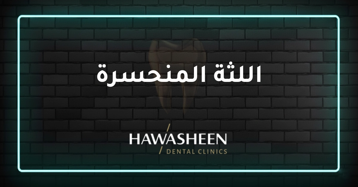 اللثة المنحسرة - Dr Eyad Hawasheen - Hawasheen Dental Clinics
