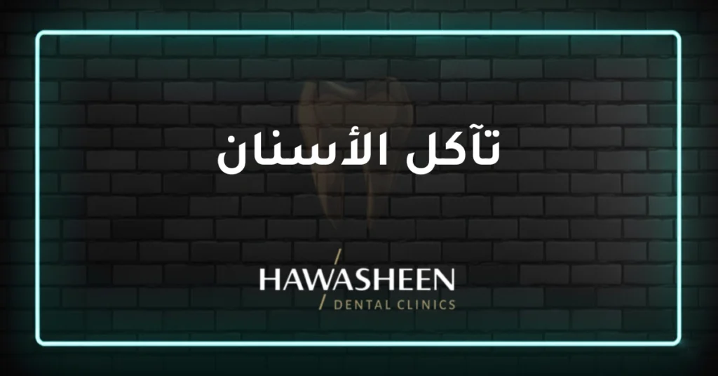تآكل الأسنان - Dr Eyad Hawasheen - Hawasheen Dental Clinics