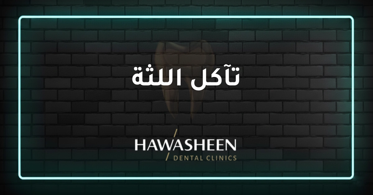 تآكل اللثة - Dr Eyad Hawasheen - Hawasheen Dental Clinics