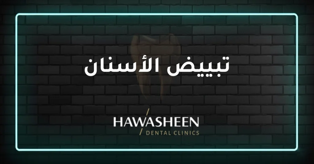 تبييض الأسنان - Dr Eyad Hawasheen - Hawasheen Dental Clinics