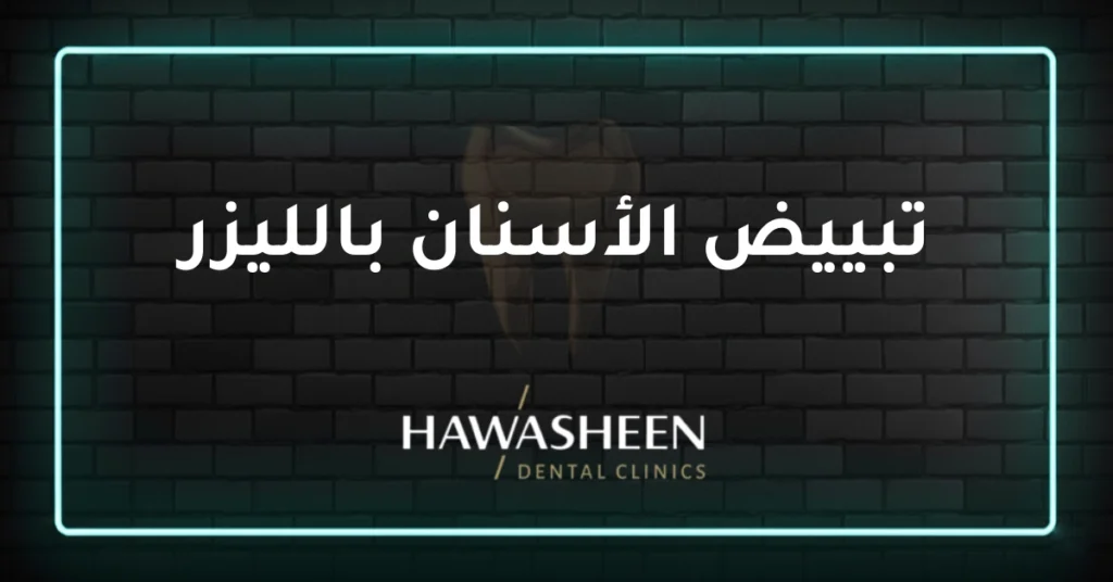 تبييض الأسنان بالليزر - Dr Eyad Hawasheen - Hawasheen Dental Clinics