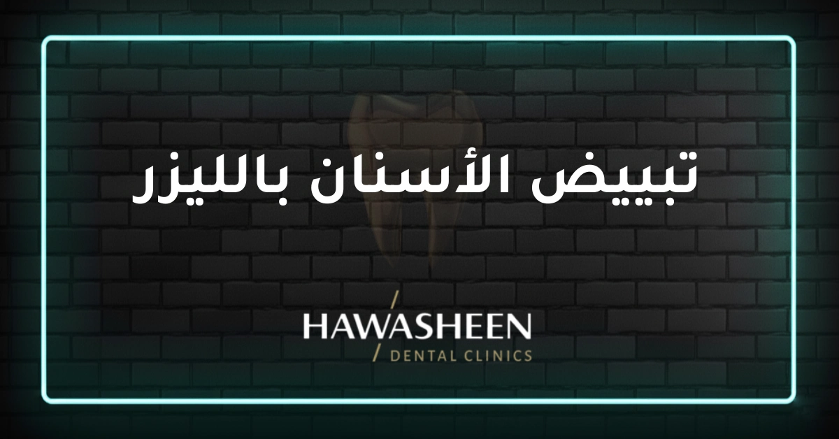 تبييض الأسنان بالليزر - Dr Eyad Hawasheen - Hawasheen Dental Clinics
