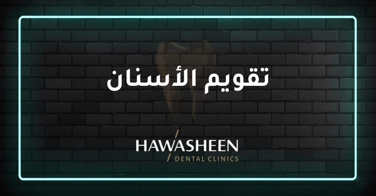 تقويم الأسنان - Dr Eyad Hawasheen - Hawasheen Dental Clinics