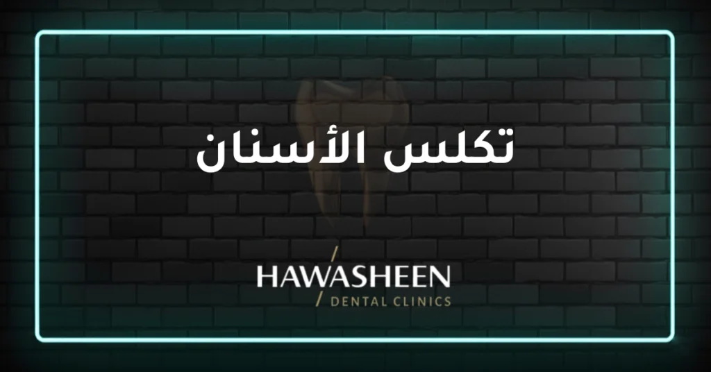 تكلس الأسنان - Dr Eyad Hawasheen - Hawasheen Dental Clinics