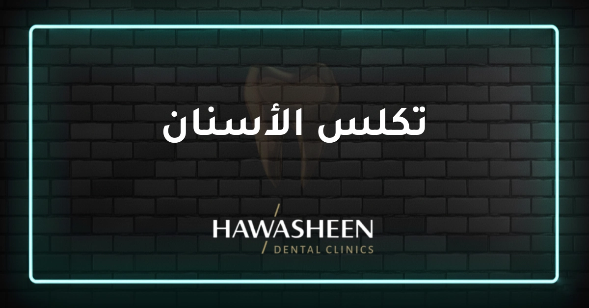 تكلس الأسنان - Dr Eyad Hawasheen - Hawasheen Dental Clinics