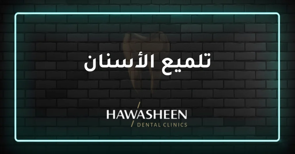 تلميع الأسنان - Dr Eyad Hawasheen - Hawasheen Dental Clinics
