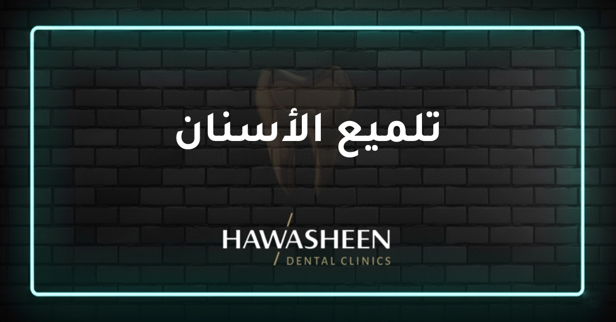 تلميع الأسنان - Dr Eyad Hawasheen - Hawasheen Dental Clinics