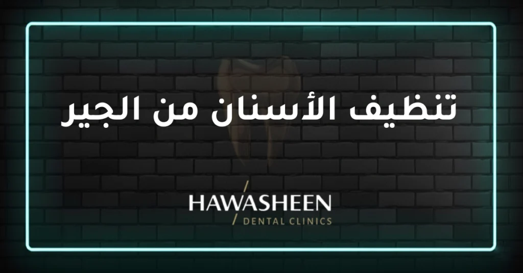 تنظيف الأسنان من الجير - Dr Eyad Hawasheen - Hawasheen Dental Clinics