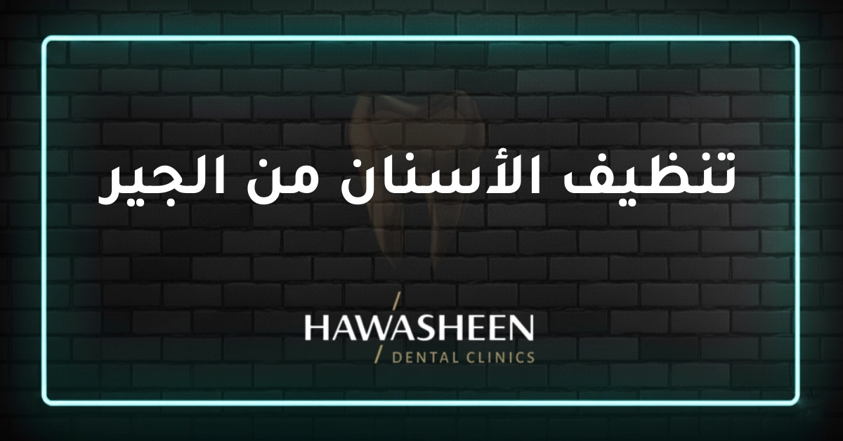 تنظيف الأسنان من الجير - Dr Eyad Hawasheen - Hawasheen Dental Clinics