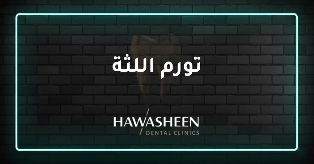 تورم اللثة - Dr Eyad Hawasheen - Hawasheen Dental Clinics