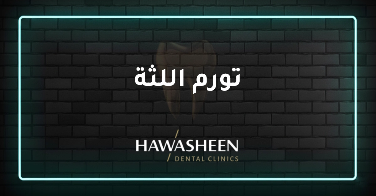 تورم اللثة - Dr Eyad Hawasheen - Hawasheen Dental Clinics