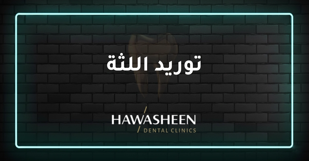 توريد اللثة - Dr Eyad Hawasheen - Hawasheen Dental Clinics