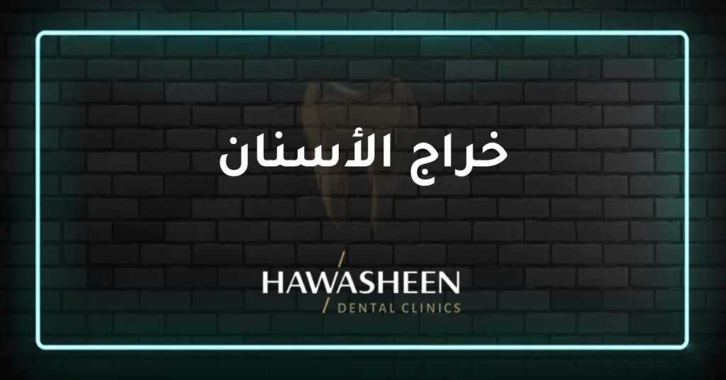 خراج الأسنان - Dr Eyad Hawasheen - Hawasheen Dental Clinics