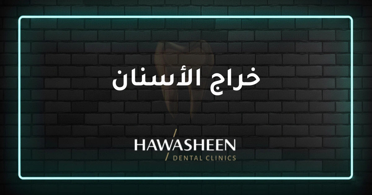 خراج الأسنان - Dr Eyad Hawasheen - Hawasheen Dental Clinics