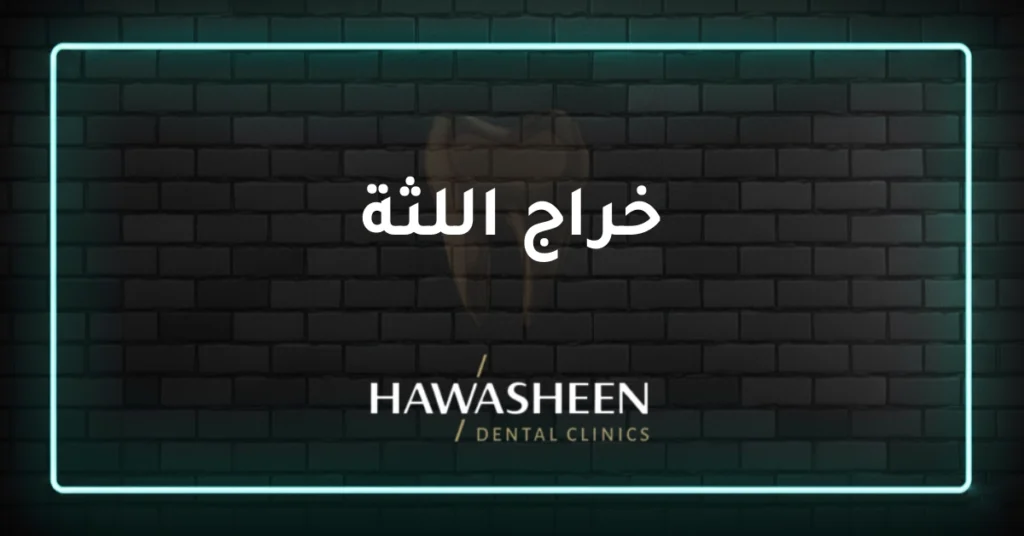 خراج اللثة - Dr Eyad Hawasheen - Hawasheen Dental Clinics