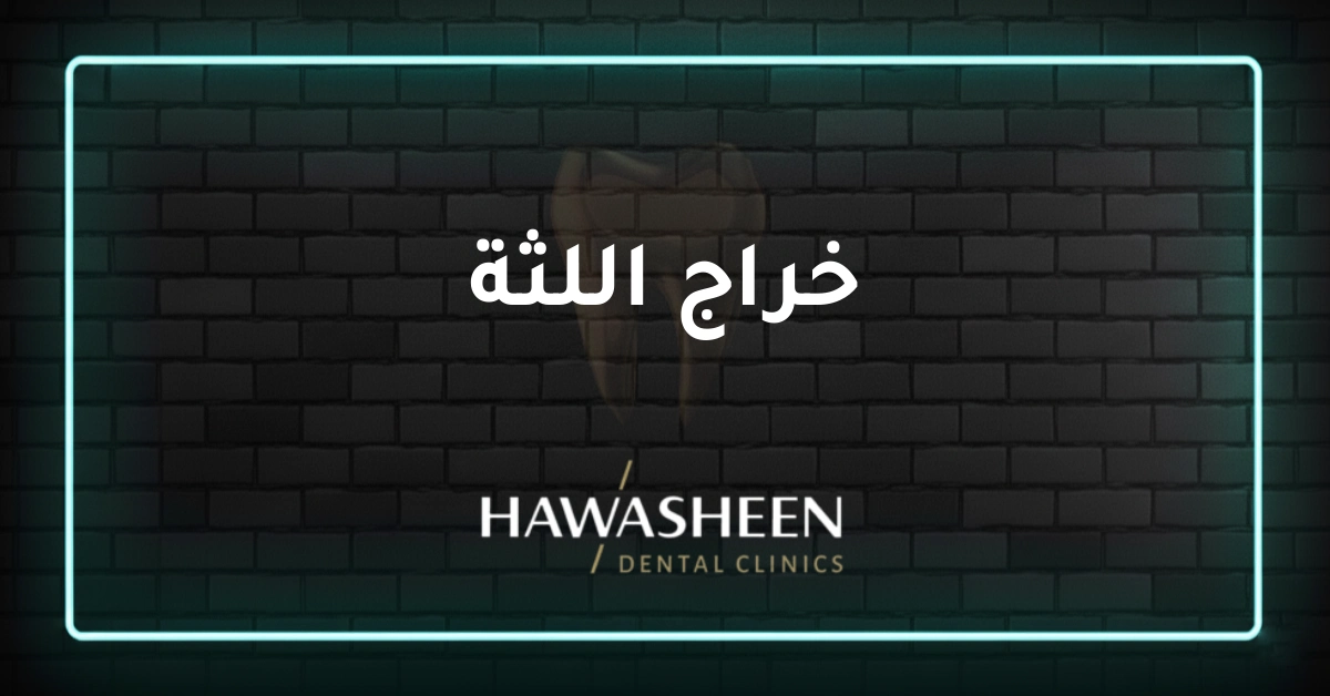 خراج اللثة - Dr Eyad Hawasheen - Hawasheen Dental Clinics