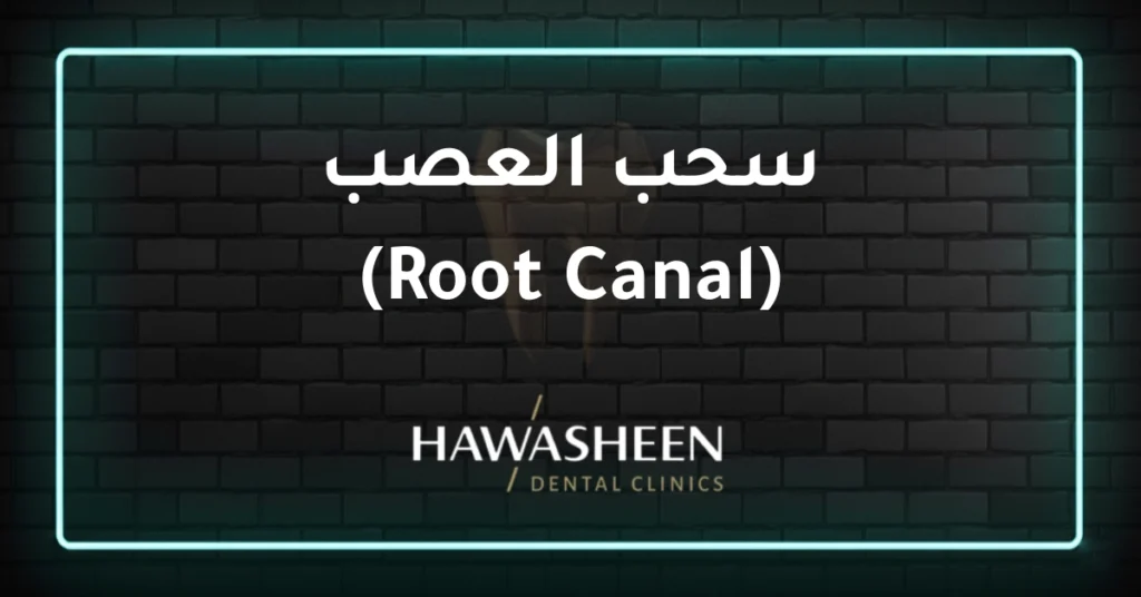 سحب العصب (Root Canal) - Dr Eyad Hawasheen - Hawasheen Dental Clinics