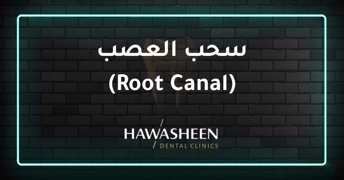 سحب العصب (Root Canal) - Dr Eyad Hawasheen - Hawasheen Dental Clinics