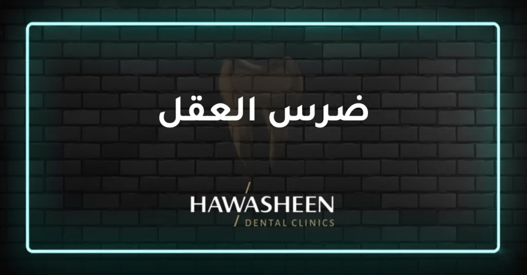 ضرس العقل - Dr Eyad Hawasheen - Hawasheen Dental Clinics