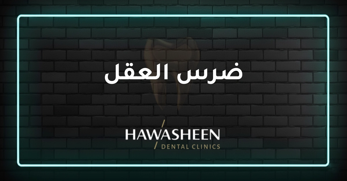 ضرس العقل - Dr Eyad Hawasheen - Hawasheen Dental Clinics
