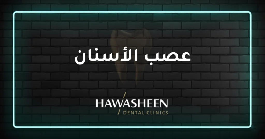 عصب الأسنان - Dr Eyad Hawasheen - Hawasheen Dental Clinics