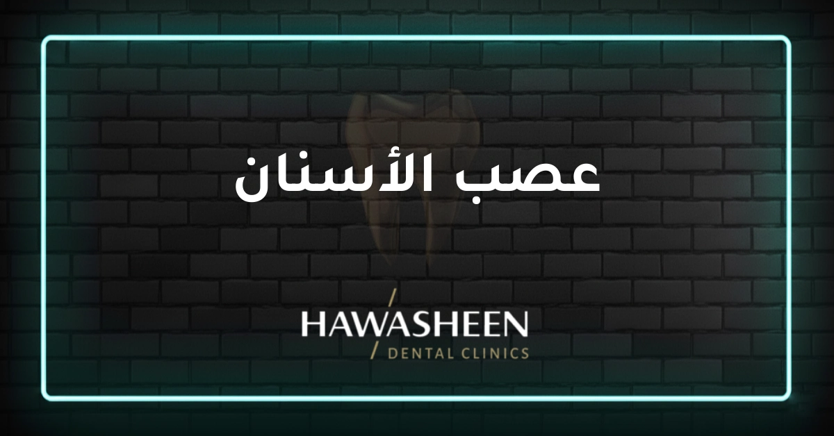 عصب الأسنان - Dr Eyad Hawasheen - Hawasheen Dental Clinics