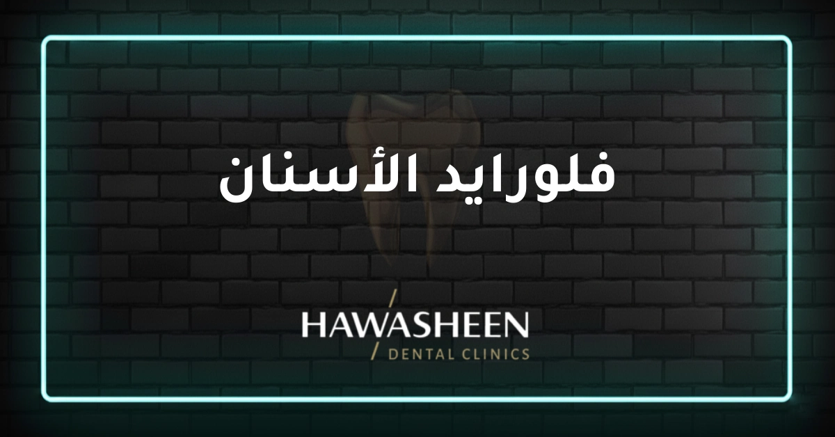فلورايد الأسنان - Dr Eyad Hawasheen - Hawasheen Dental Clinics