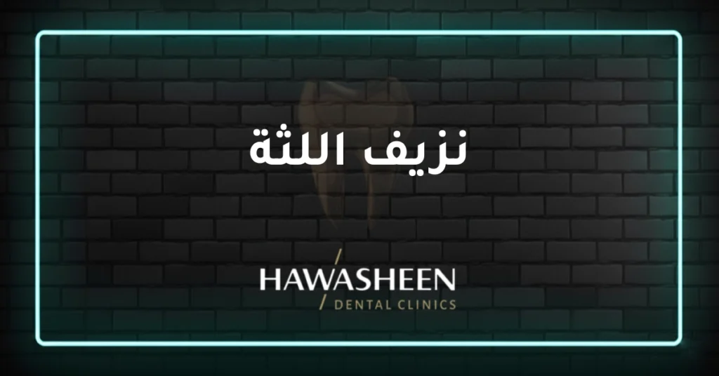 نزيف اللثة - Dr Eyad Hawasheen - Hawasheen Dental Clinics