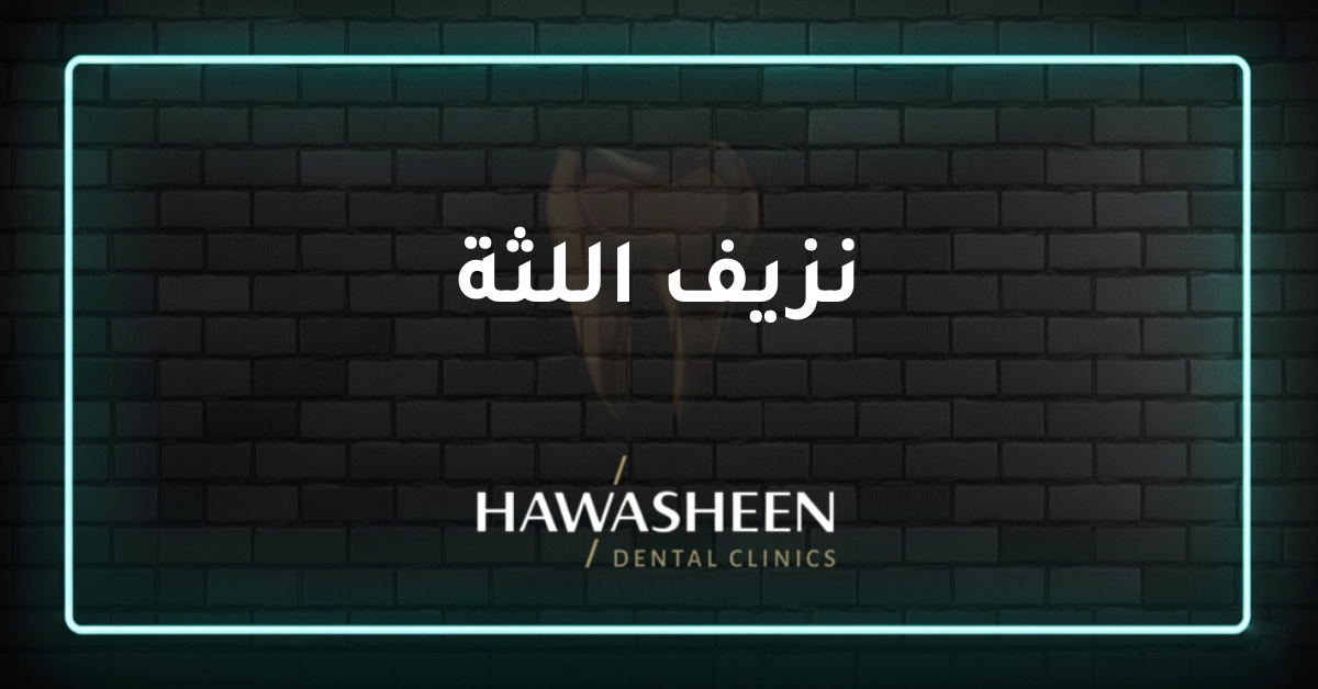 نزيف اللثة - Dr Eyad Hawasheen - Hawasheen Dental Clinics